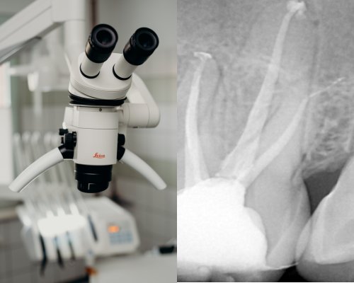 Endodoncja